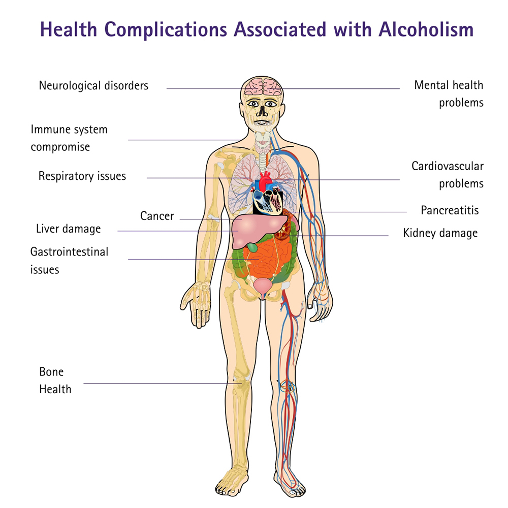 Health Complications Associated with Alcoholism