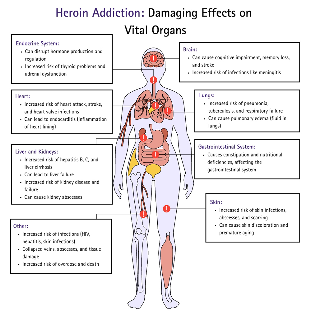 Heroin Addiction Damaging Effects on Vital Organs